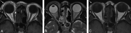 Fig 3.
