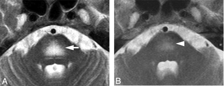 Fig 5.