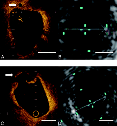 Fig 2.