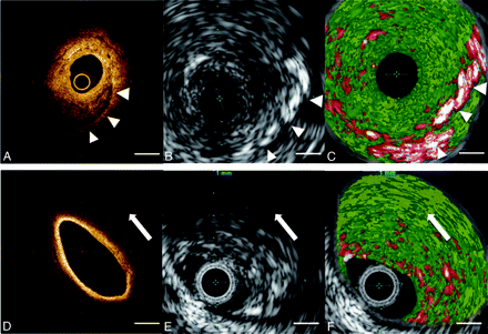 Fig 3.