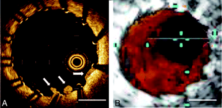 Fig 4.