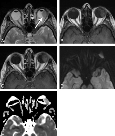 Fig 1.