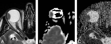 Fig 2.