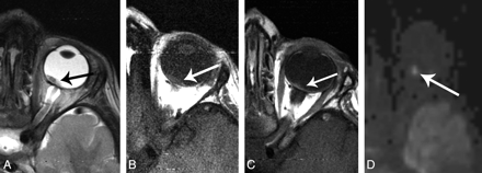 Fig 6.