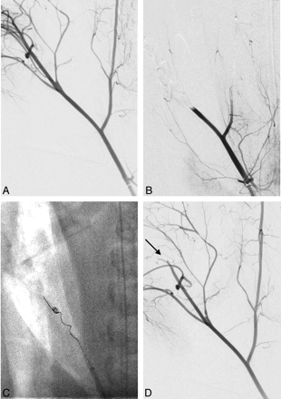Fig 3.