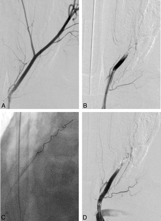 Fig 4.