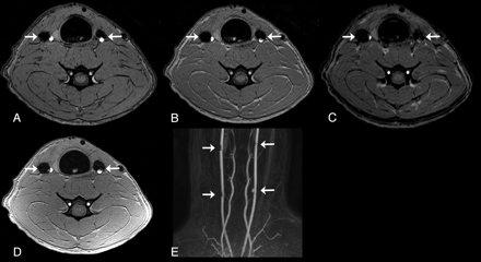 Fig 1.