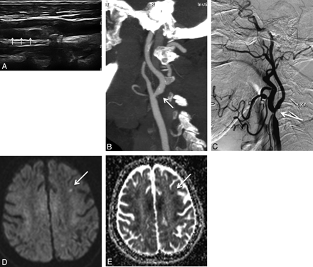 Fig 1.
