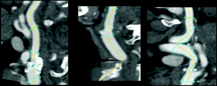 Fig 5.