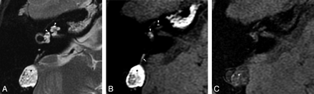 Fig 3.