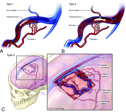 Fig 2.