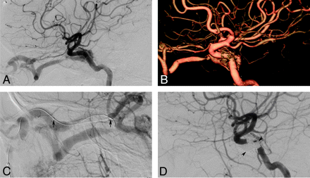 Fig 4.