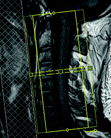 Fig 2.