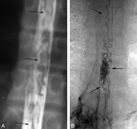 Fig 4.