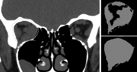 Fig 3.