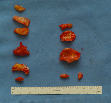 Fig 2.