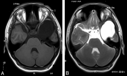 Fig 3.