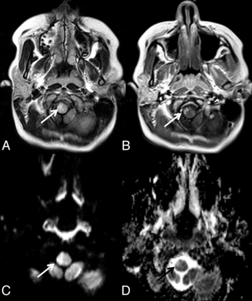 Fig 3.