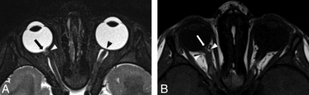 Fig 2.