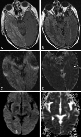Fig 3.