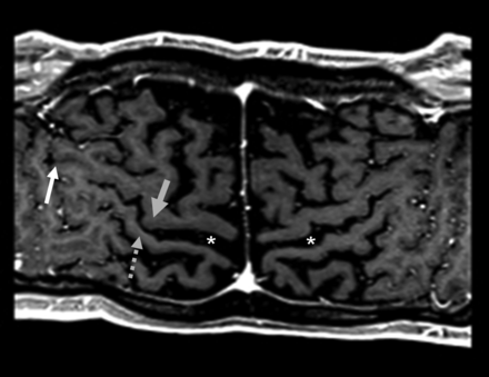 Fig 3.