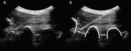 Fig 1.