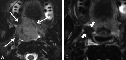 Fig 1.