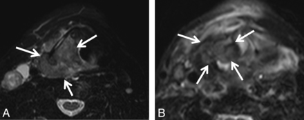 Fig 3.