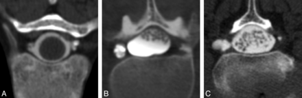 Fig 3.