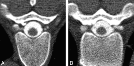 Fig 6.
