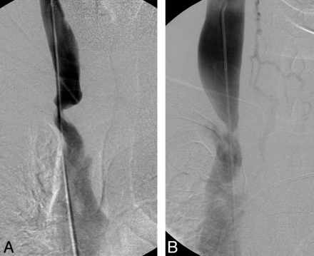 Fig 3.