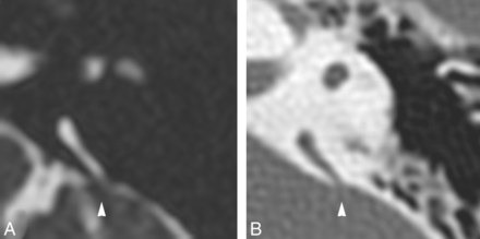 Fig 4.