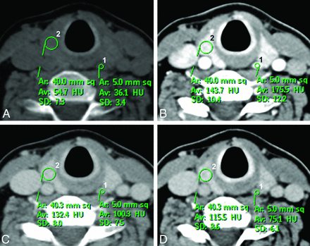 Fig 2.
