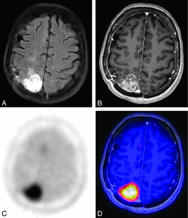 Fig 1.