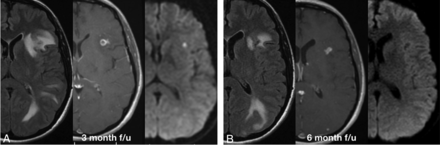 Fig 3.