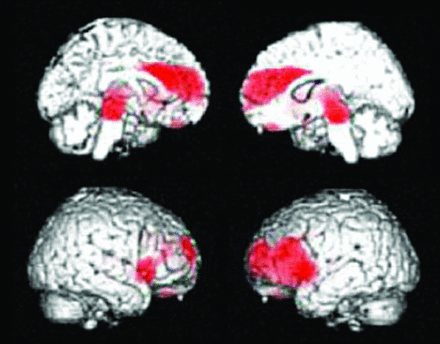 Fig 9.