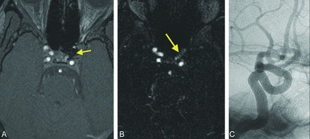 Fig 3.