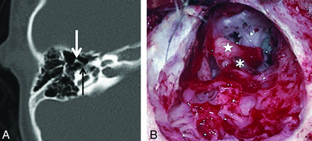 Fig 3.