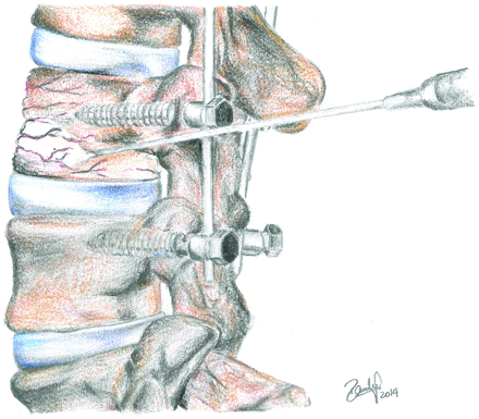Fig 1.
