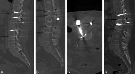 Fig 2.