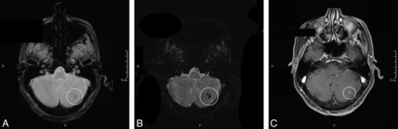 Fig 2.