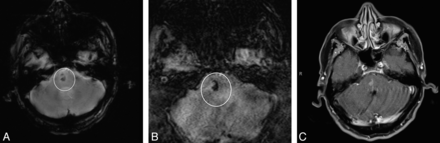 Fig 3.