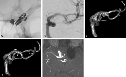 Fig 5.