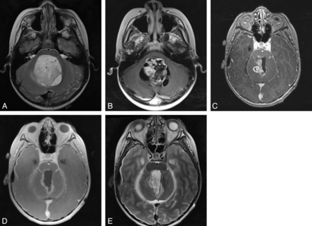 Fig 1.