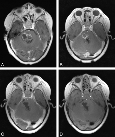 Fig 2.