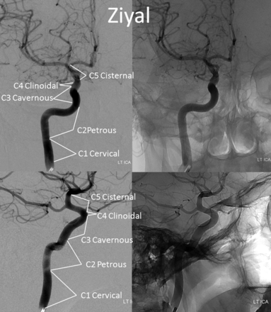 Fig 4.