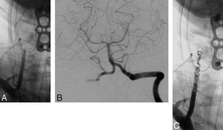 Fig 2.