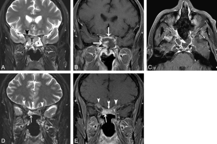 Fig 5.