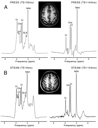 Fig 1.