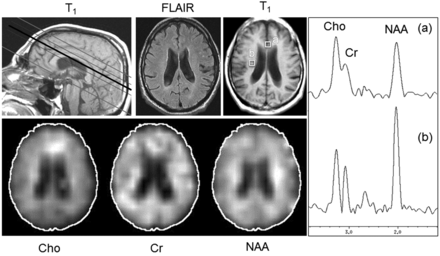 Fig 2.